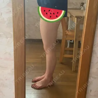 3日目の経過画像（2枚目）