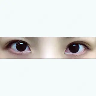14日目の経過画像（2枚目）