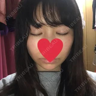 8日目の経過画像（1枚目）