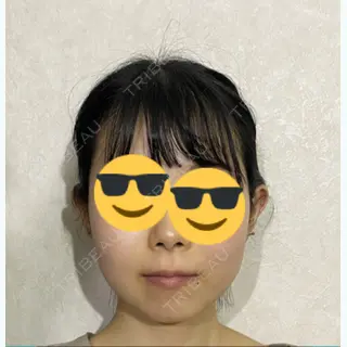 92日目の経過画像（1枚目）