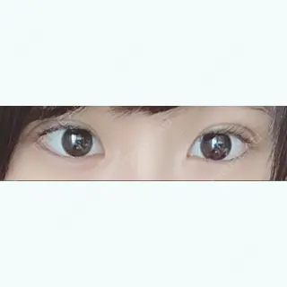 2日目の経過画像（1枚目）