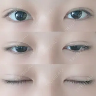 20日目の経過画像（1枚目）