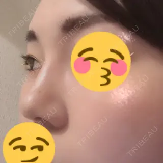 9日目の経過画像（1枚目）