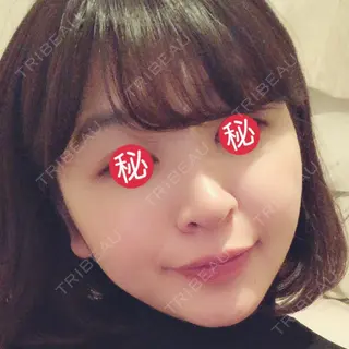 42日目の経過画像（2枚目）