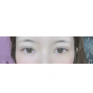 6日目の経過画像（1枚目）