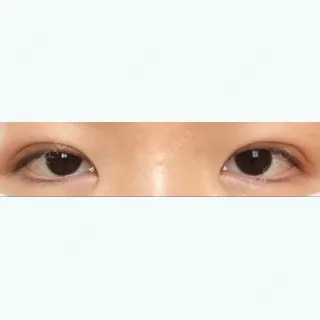 1日目の経過画像（1枚目）