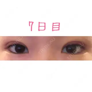 7日目の経過画像（1枚目）