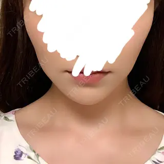 37日目の経過画像（1枚目）