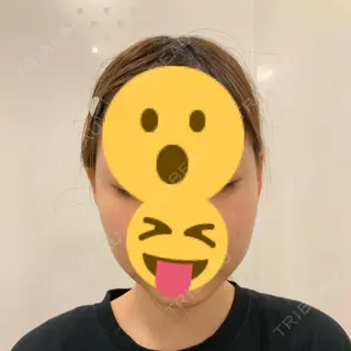 0日目の経過画像（1枚目）