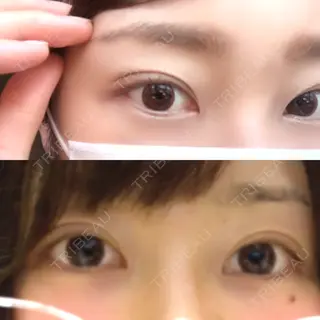 232日目の経過画像（1枚目）