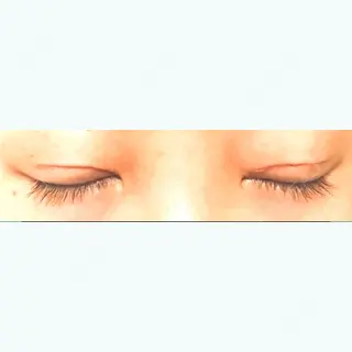 10日目の経過画像（2枚目）