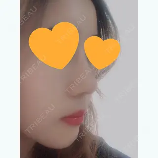 244日目の経過画像（3枚目）