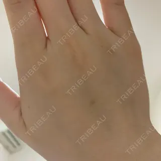 19日目の経過画像（2枚目）