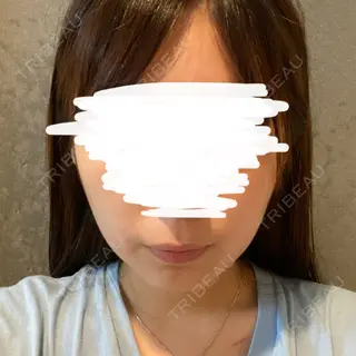 23日目の経過画像（1枚目）