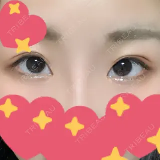 225日目の経過画像（1枚目）