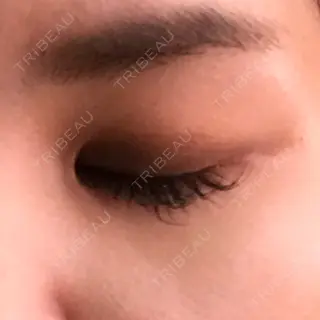 12日目の経過画像（2枚目）