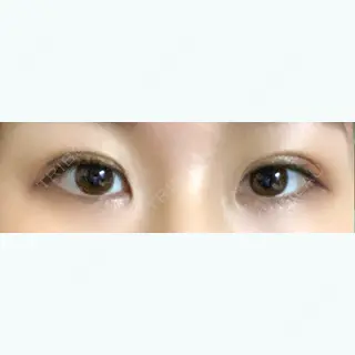 26日目の経過画像（1枚目）