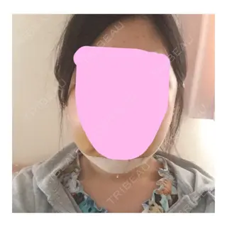 5日目の経過画像（1枚目）