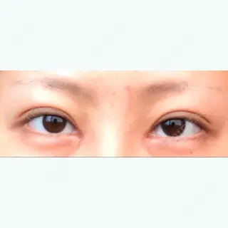 36日目の経過画像（1枚目）