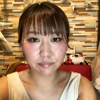 -7日目の経過画像（1枚目）
