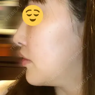 130日目の経過画像（1枚目）