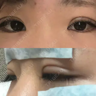 1日目の経過画像（1枚目）