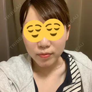 67日目の経過画像（1枚目）