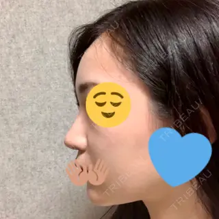 173日目の経過画像（1枚目）