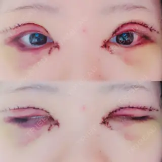 3日目の経過画像（1枚目）