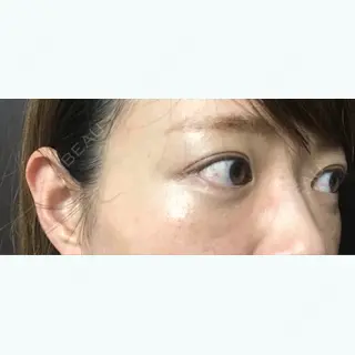 69日目の経過画像（3枚目）