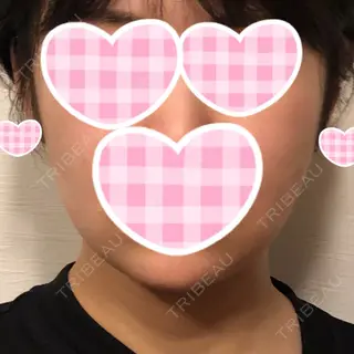 14日目の経過画像（1枚目）