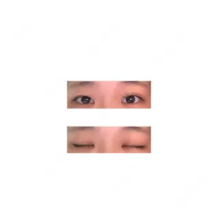 105日目の経過画像（1枚目）