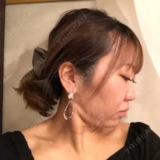 -2日目の経過画像（3枚目）