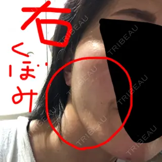 27日目の経過画像（2枚目）