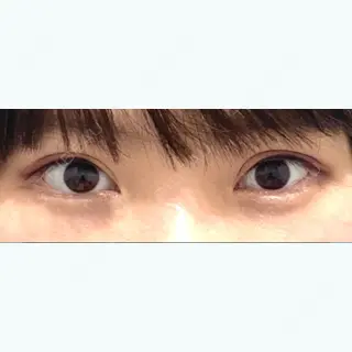 117日目の経過画像（1枚目）