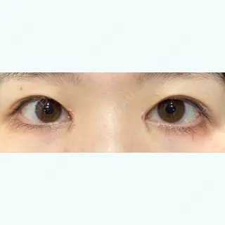 38日目の経過画像（1枚目）