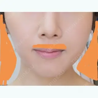 103日目の経過画像（1枚目）