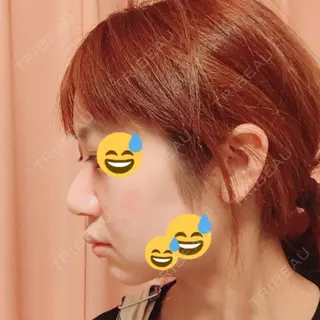 16日目の経過画像（3枚目）