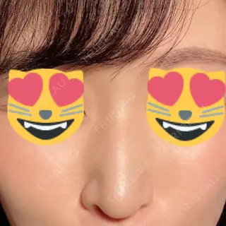 162日目の経過画像（1枚目）