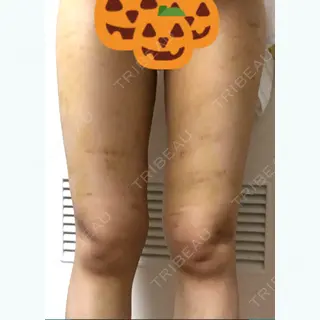 8日目の経過画像（2枚目）