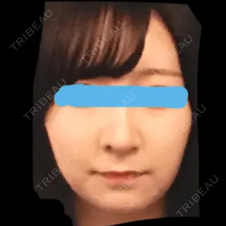 115日目の経過画像（1枚目）
