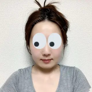 823日目の経過画像（3枚目）