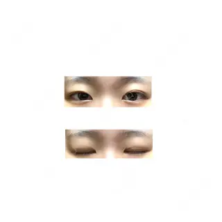 121日目の経過画像（1枚目）