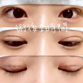0日目の経過画像（1枚目）