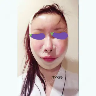 0日目の経過画像（1枚目）