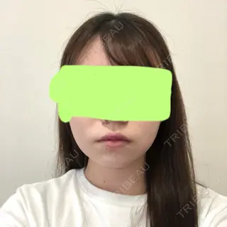 116日目の経過画像（1枚目）