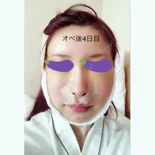 4日目の経過画像（1枚目）