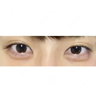 2日目の経過画像（1枚目）