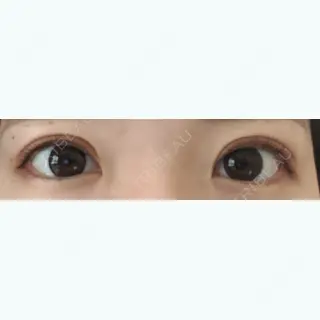 296日目の経過画像（1枚目）