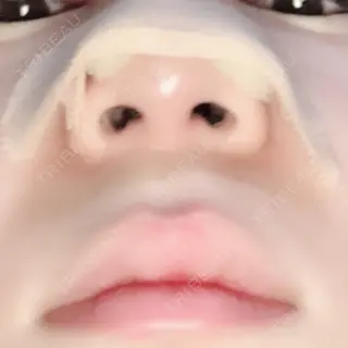 2日目の経過画像（2枚目）